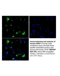 anti-GFAP Antibody - Monoclonal (Clone #100) 