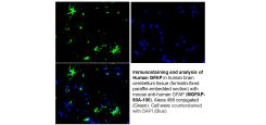 anti-GFAP Antibody - Monoclonal (Clone #100) 