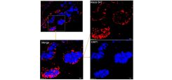 anti-Epididymis Protein 4 (HE4) Antibody (Mouse - Clone #9F6) -  Monoclonal 